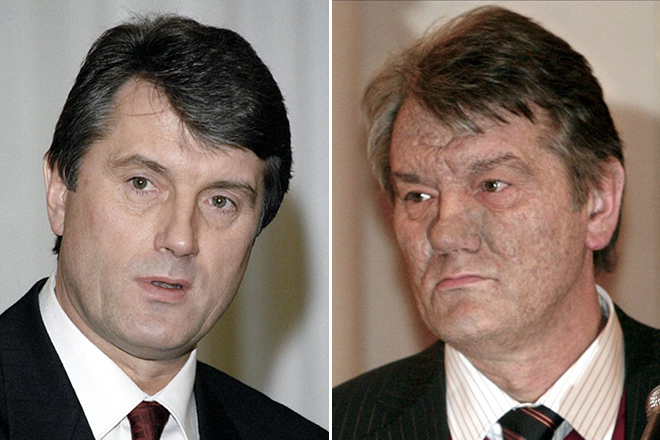Виктор Ющенко до и после отравления