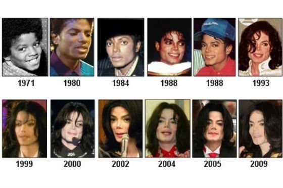 Как менялась внешность Майкла Джексона