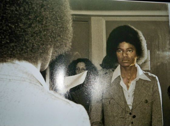 Витилиго проявилась у Майкла Джексона в юности