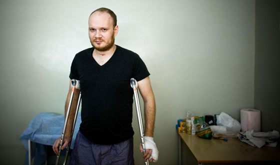 Блогера Олега Кашина избили вскоре после стычки с Андреем Турчаком